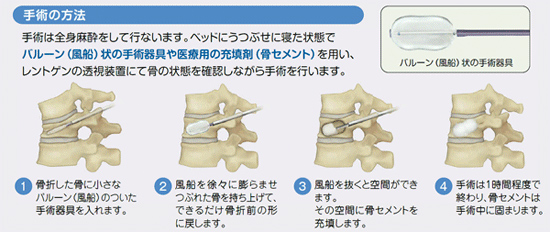 手術の方法